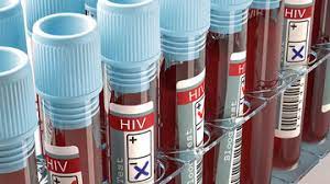 معاون بهداشت دانشگاه علوم پزشکی لرستان: ۵ هزار خدمت کلینیک سیار به افراد در معرض خطر ابتلا به HIV ارائه شد