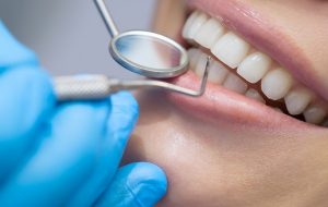 پوسیدگی، جرم گیری و ساخت دندان تحت پوشش بیمه قرار می‌گیرند