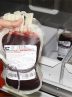 ۹۸ درصد خون‌های اهدایی در ایران تبدیل به فرآورده می‌شود